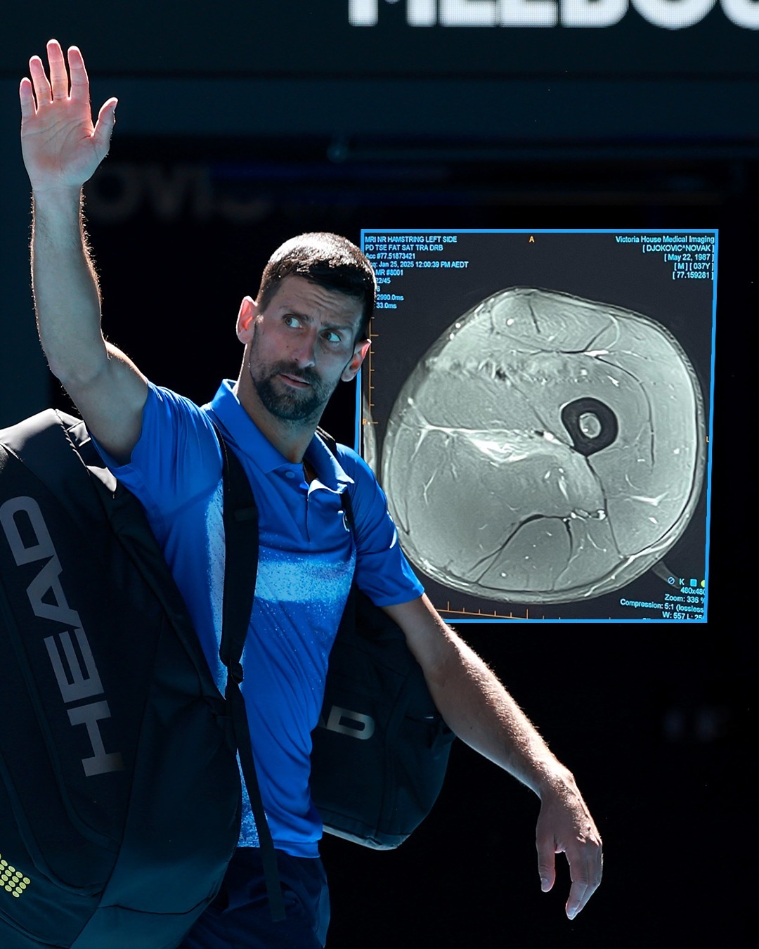 包含西班牙网球队强势世界网球队，德约科维奇送出助攻的词条